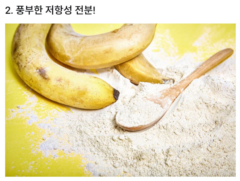 티엔엠 이미지