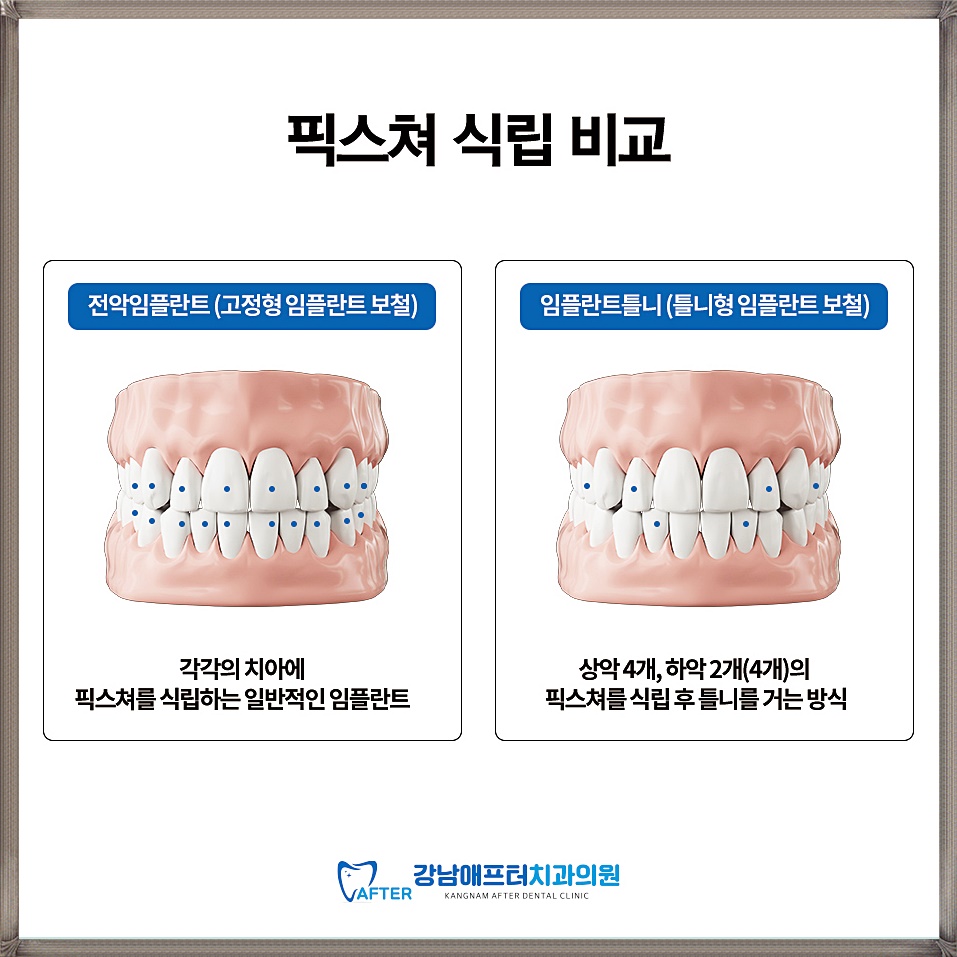 이-프란트치과 이미지