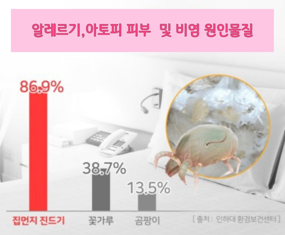 아토피하우스 이미지
