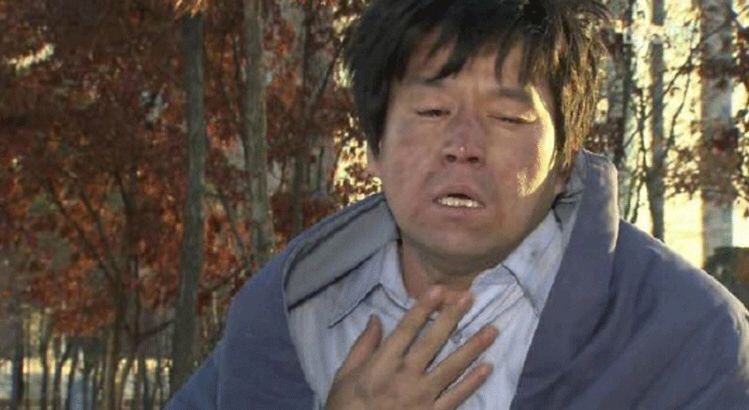 더마일스톤 이미지