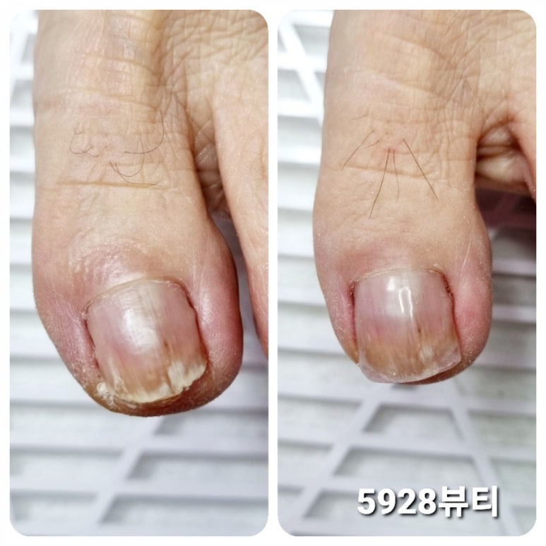 5928뷰티 이미지
