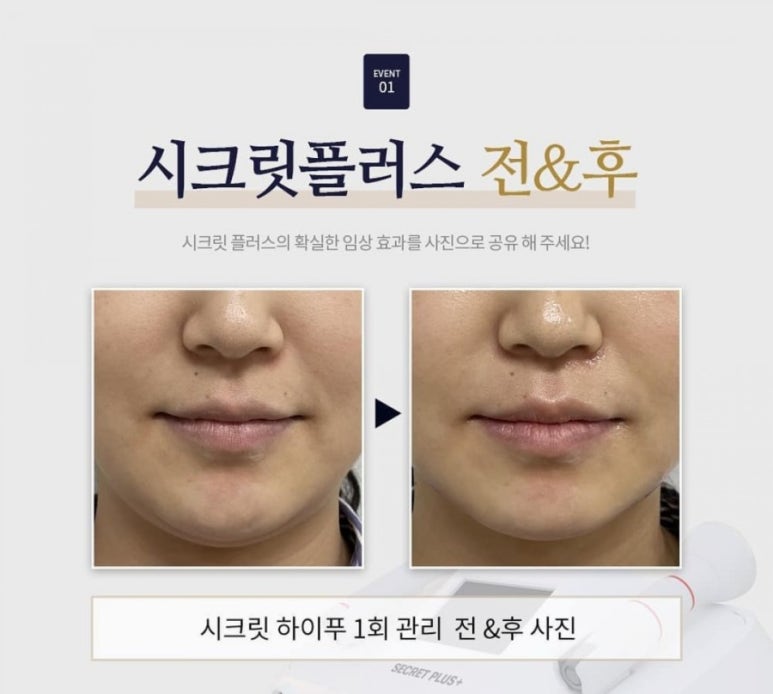 보니토에스테틱 이미지