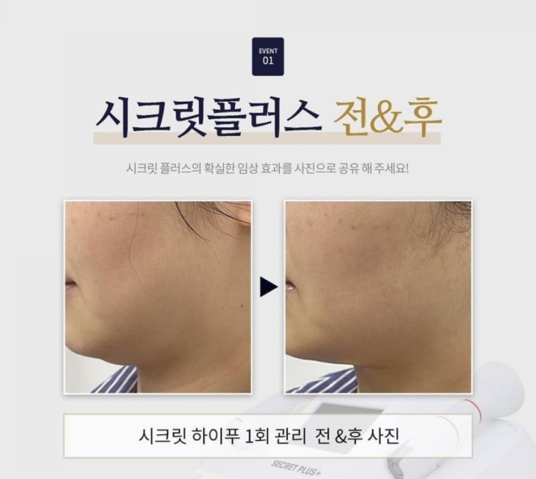 보니토에스테틱 이미지