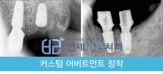 연세바른치과 이미지