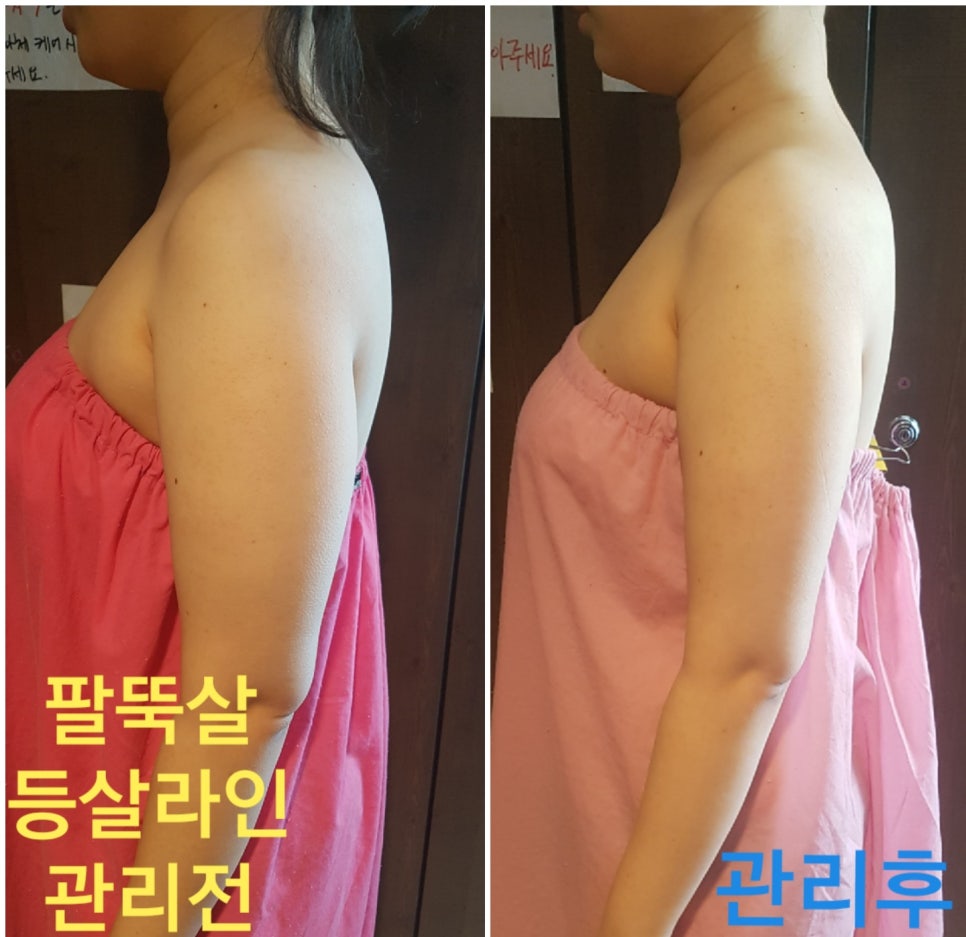 원하 에스테틱 이미지