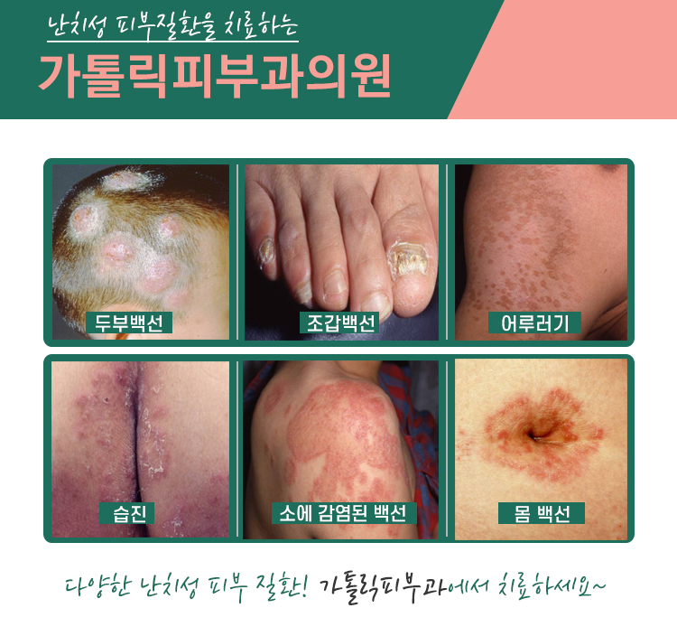 칠곡가톨릭피부과의원 이미지