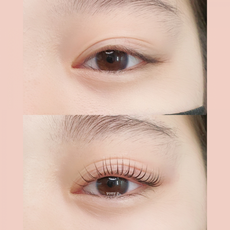 요니뷰티 이미지