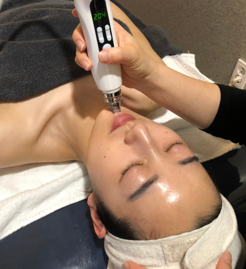 가림피부관리 이미지
