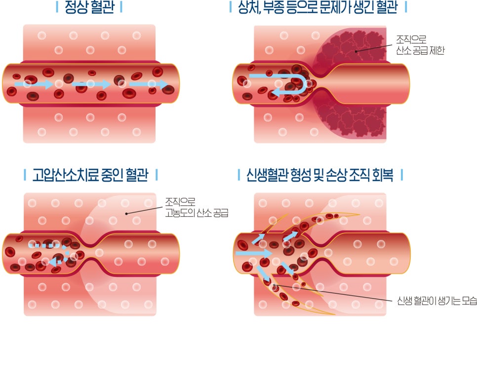 동일산소 이미지