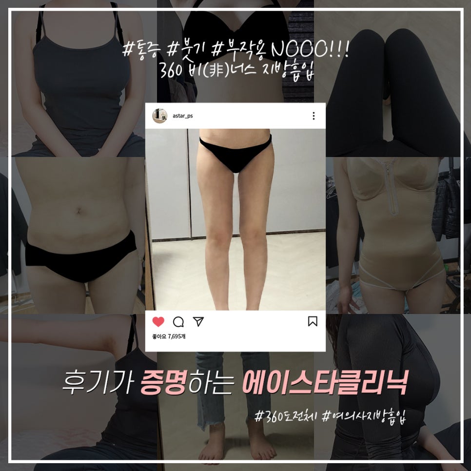 에이스타 이미지