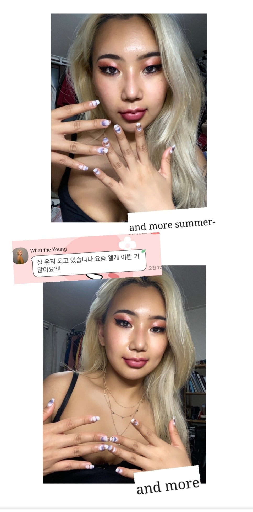 근영나염 이미지