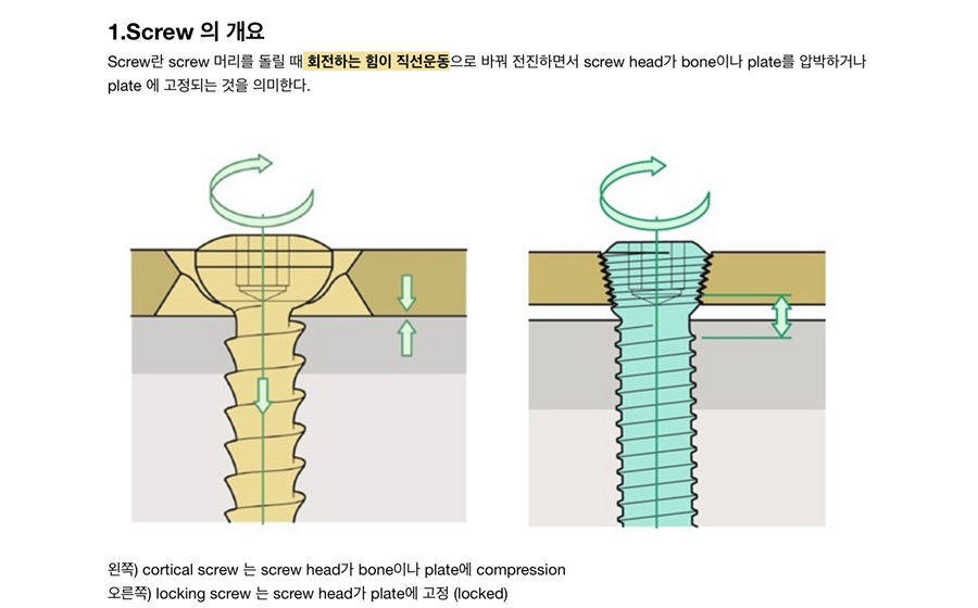 OS screw 에 대하여 (cortical vs cancellous) 네이버 블로그