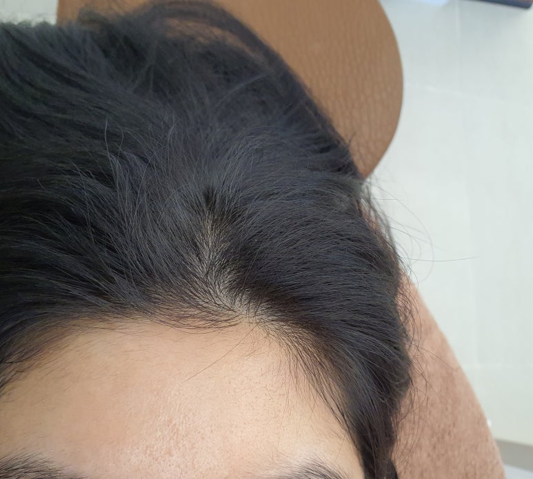 헤어끌리네 이미지