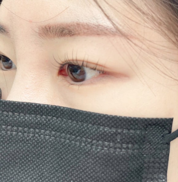EYE이뻐 이미지