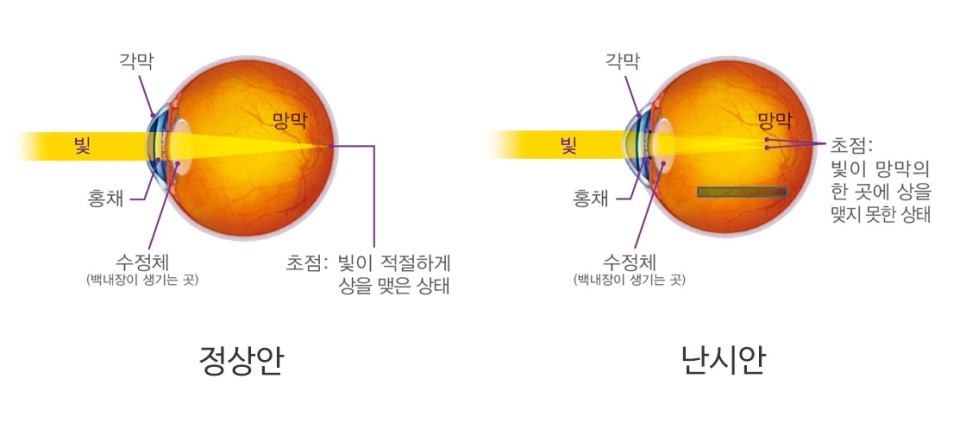 새봄안과 이미지
