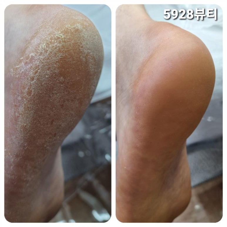 5928뷰티 이미지