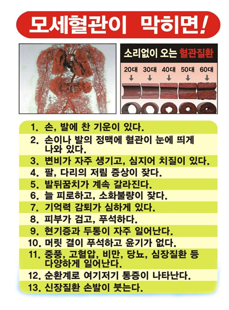 상상크린 이미지