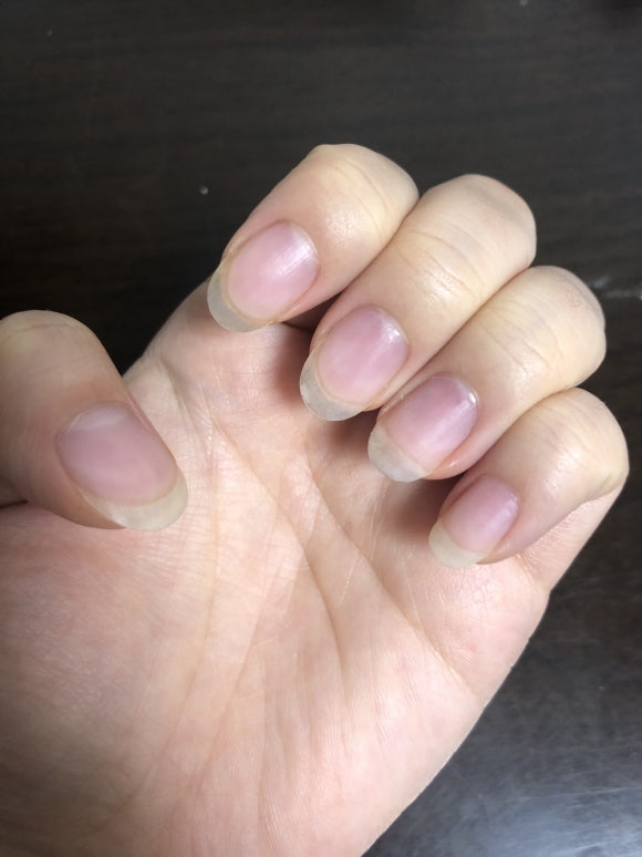 오늘해네일 이미지