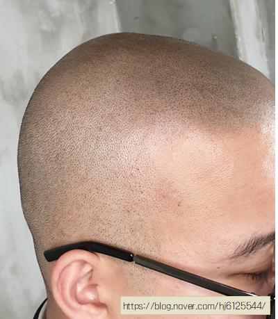 퀸헤어라인 이미지