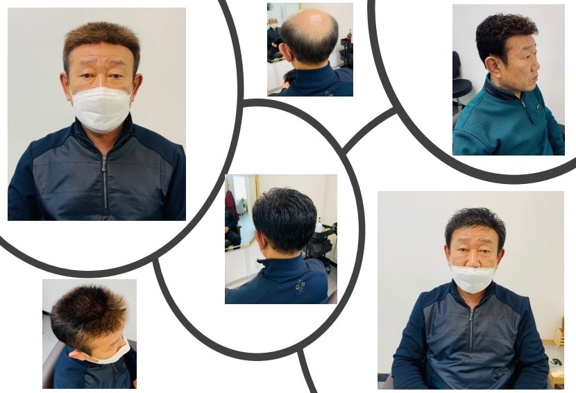 재구가발 이미지