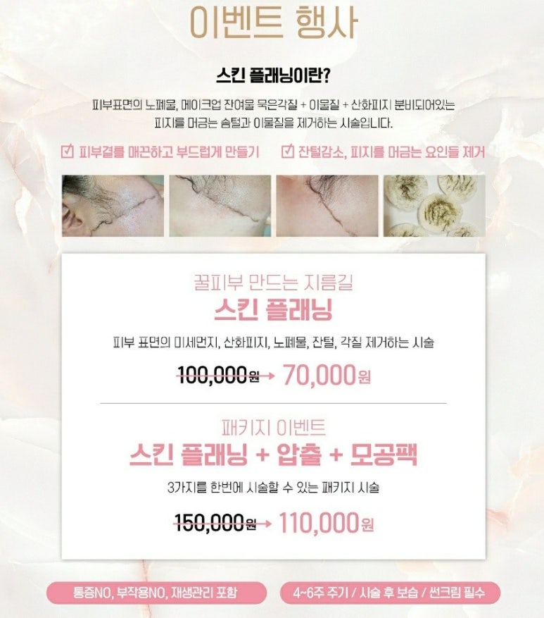 제이스킨 이미지