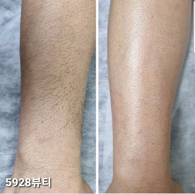 5928뷰티 이미지