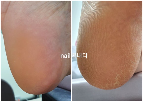 네일뽐내다 이미지