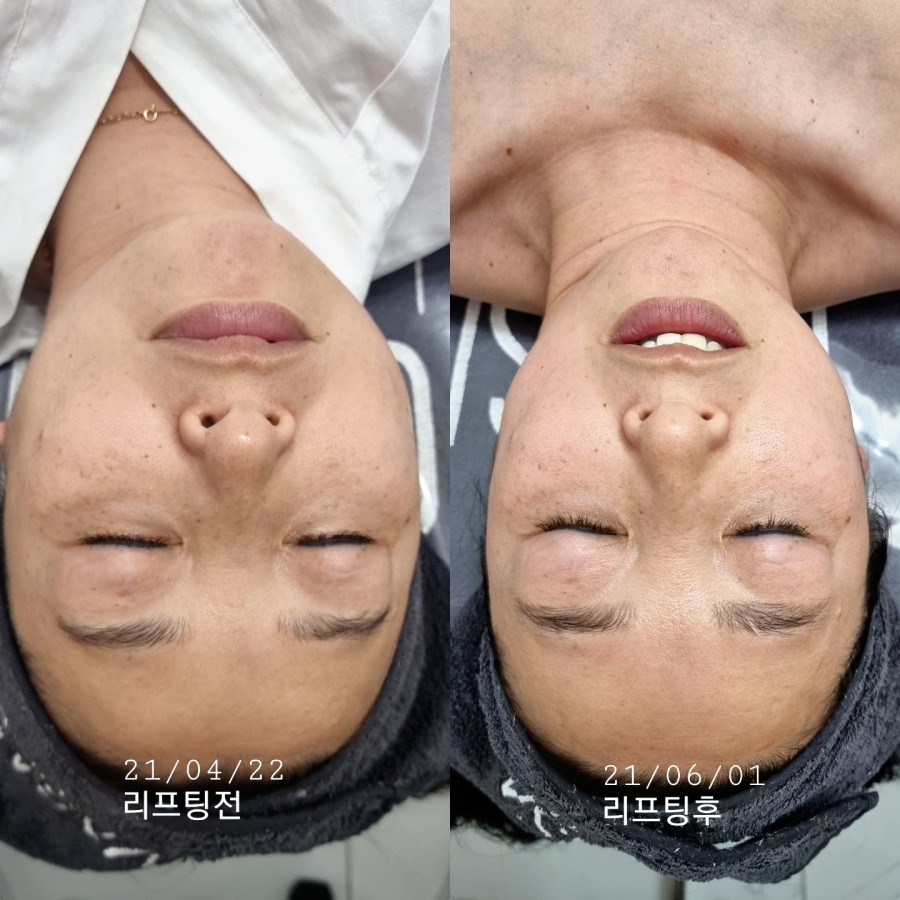 화이트스킨케어 이미지