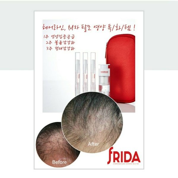 뷰티수 이미지