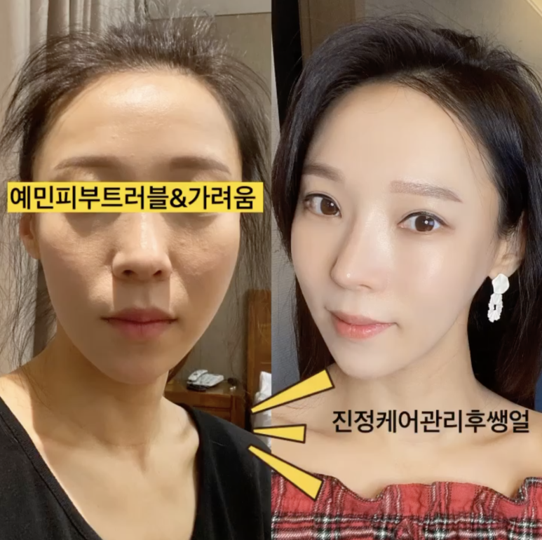 두근두근홈케어 이미지