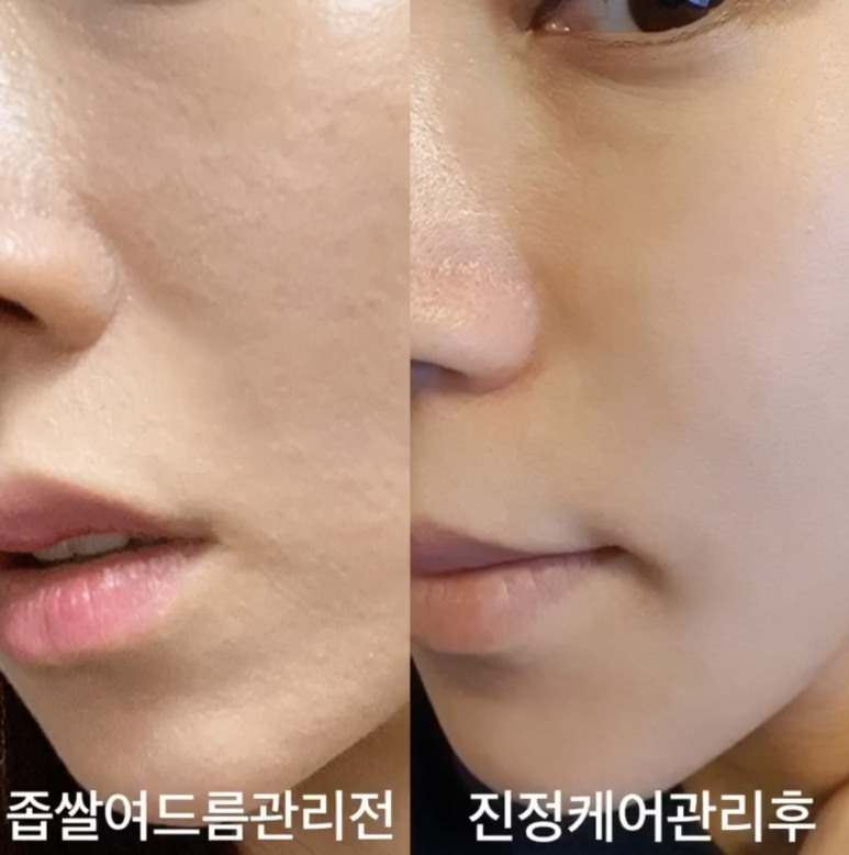 두근두근홈케어 이미지
