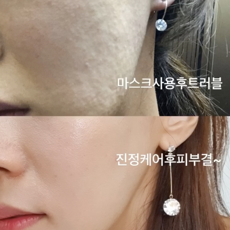 두근두근홈케어 이미지
