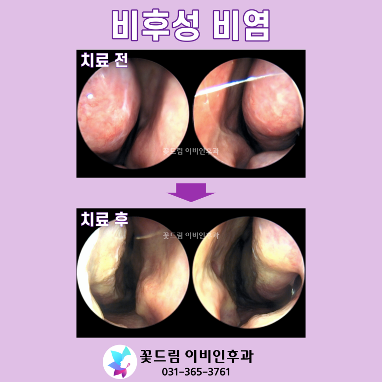 꽃드림이비인후과 이미지