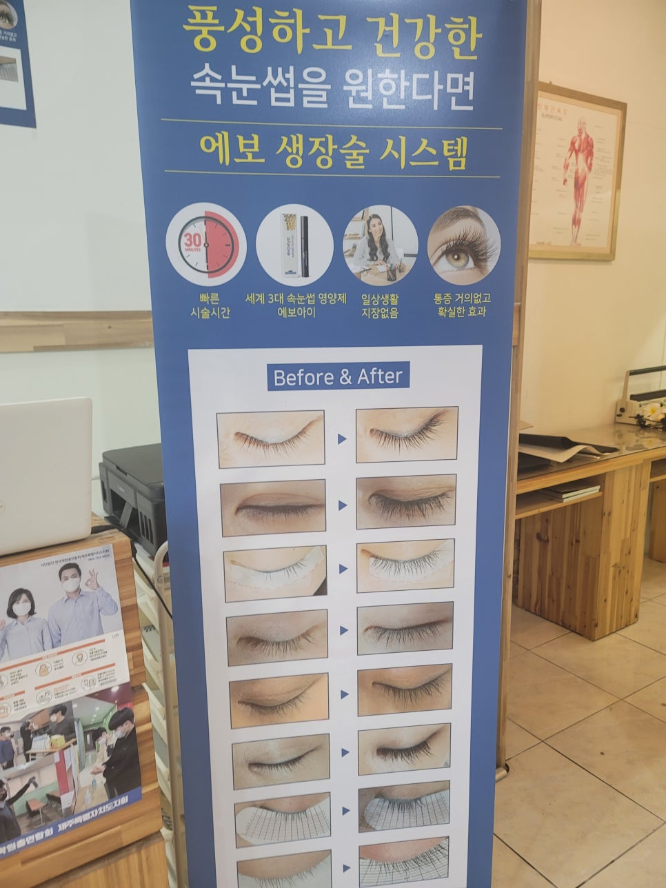 네일랩 이미지