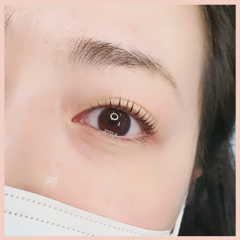 요니뷰티 이미지