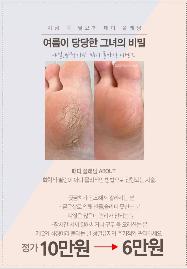 네일;반짝이다 이미지