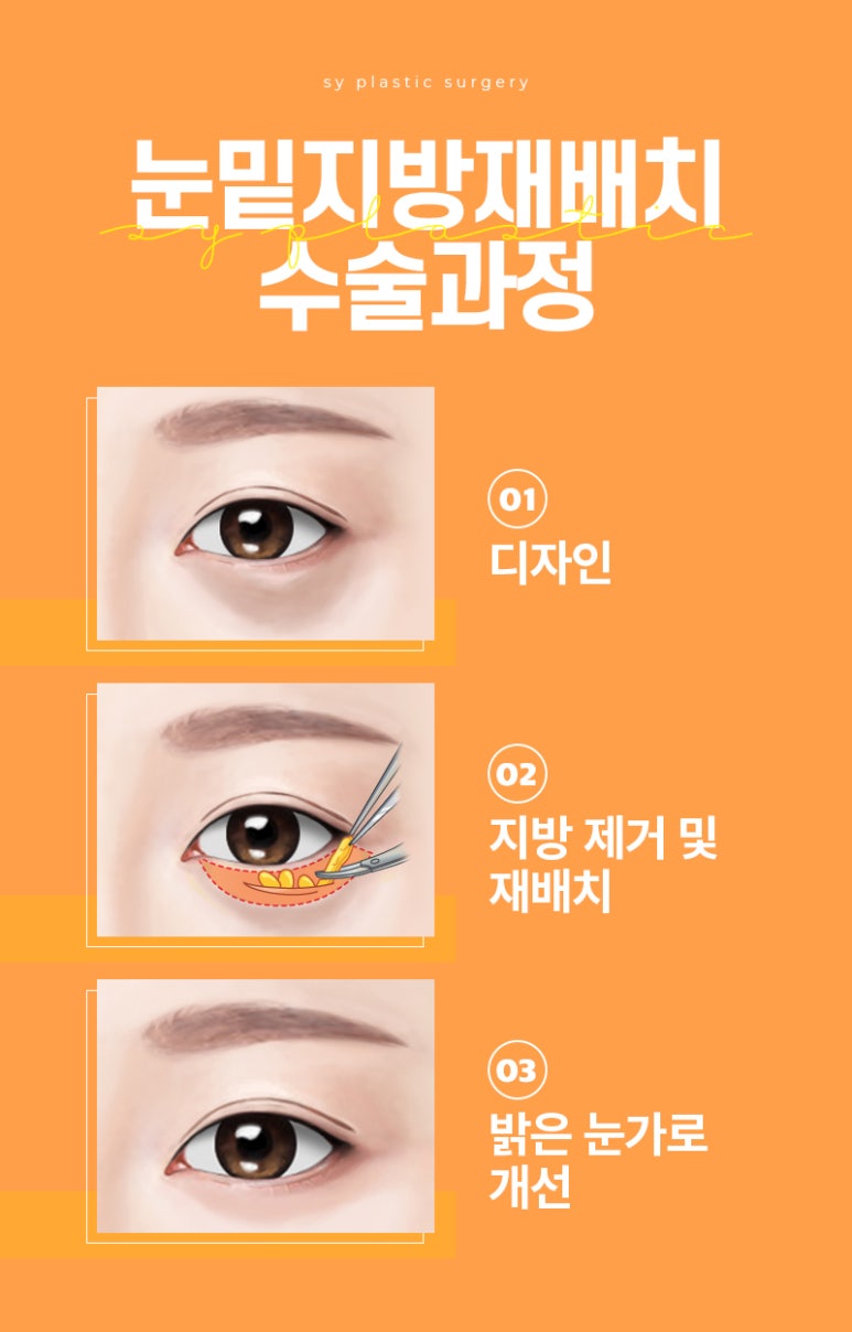 에스와이(SY) 이미지