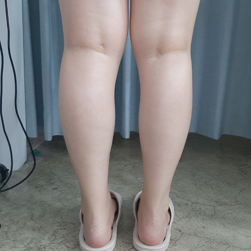 제니스킨앤바디 이미지