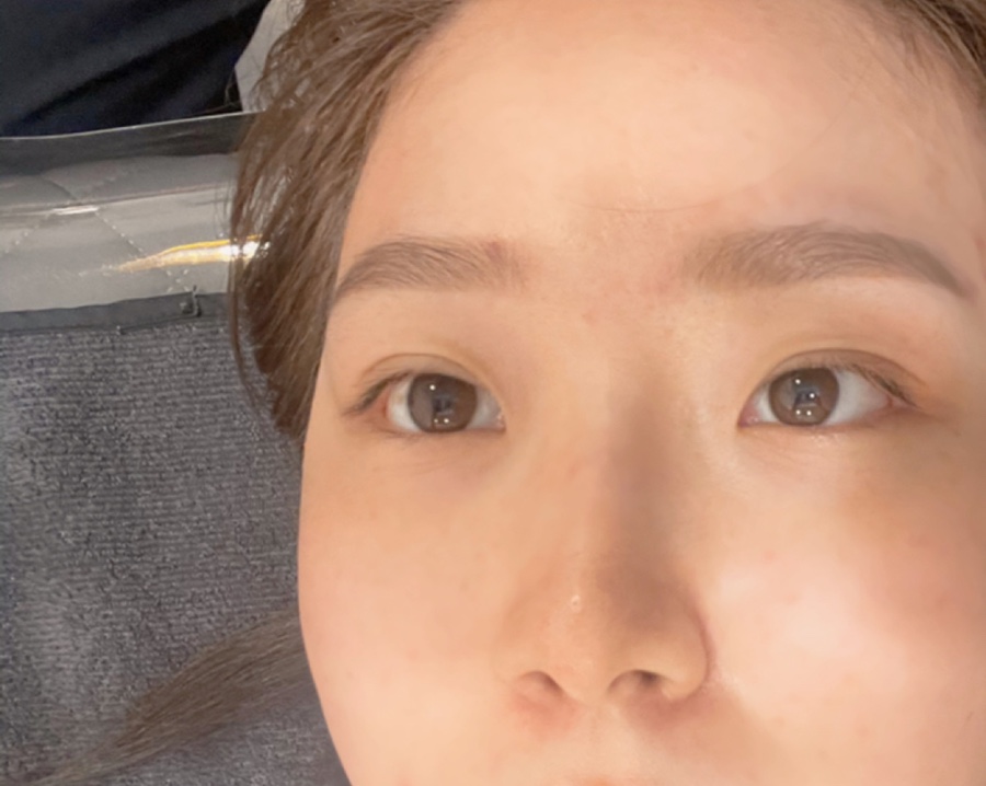 모어샤인스킨바디 이미지