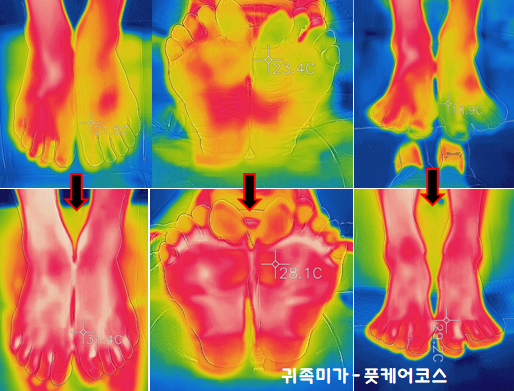 귀족체형관리 이미지