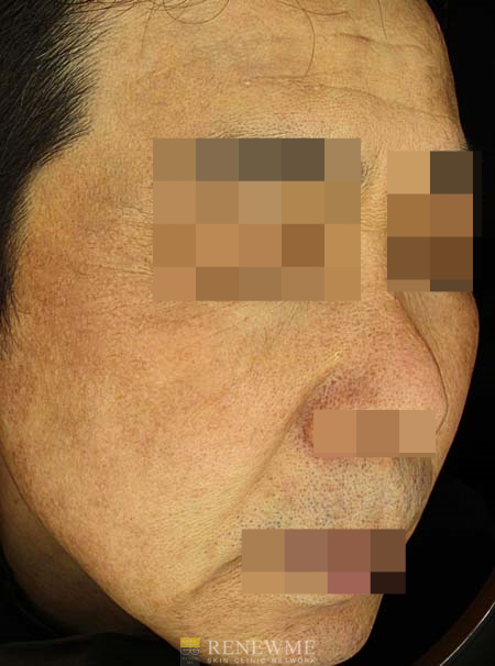 리뉴미피부과 이미지