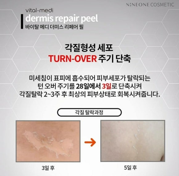 개금약초 이미지