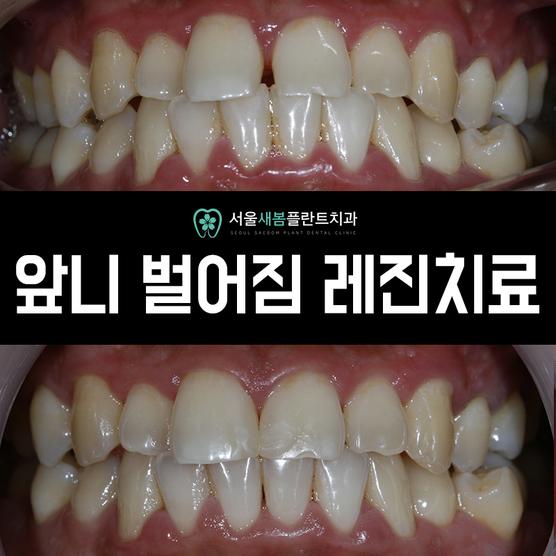 서울새봄플란트치과의원 이미지