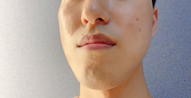 엣설 이미지
