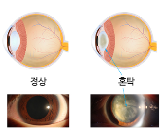밝은빛안과 이미지