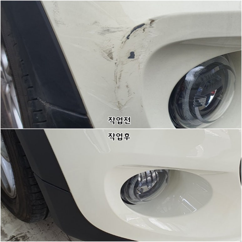 허덴트 이미지
