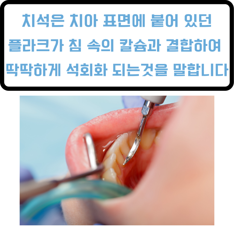 화인치과의원 이미지