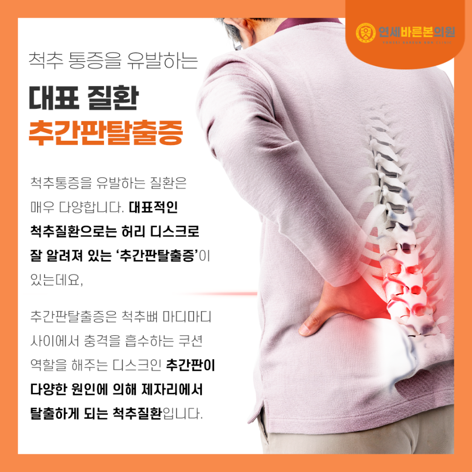 연세바로본의원 이미지