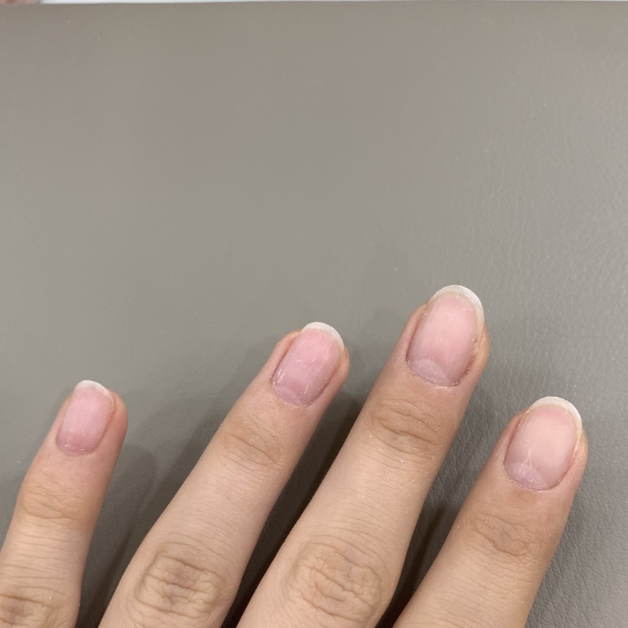 린나네일앤아이 이미지