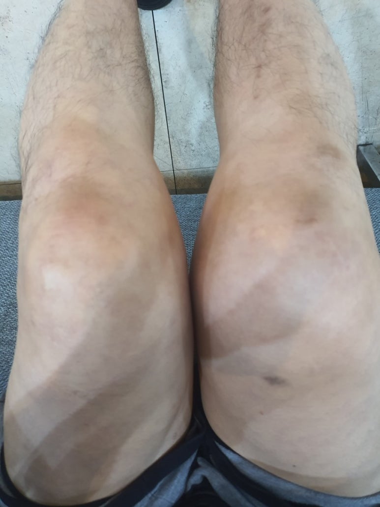 임성준신경외과 이미지